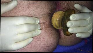 Video 265287401: prolapsed ass holes, prolapse gay, plug ass play, small prolapse, little plug, gay man playing, arsch