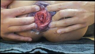 Video 749565103: fetish solo masturbation, anal fisting prolapse, prolapse fisting ass, anal prolapse fucking, fetish anal toys, solo amateur toys, extreme anal prolapse, prolapsed butt, solo male toy, fetish french