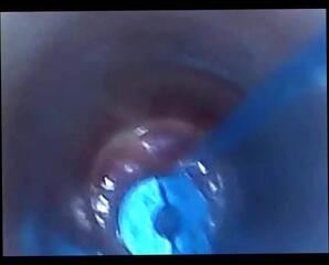 Video 276301801: bdsm pov, pov cock ball, bdsm urethral sounding, mans cock pov, big cock pov, dick pov, gay pov, insertion pov, play pov, cock urethra