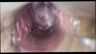 Video 1628627895: speculum orgasm, pussy speculum, speculum masturbation, speculum inside, masturbate pussy female orgasm, orgasm masturbate horny, vagina orgasm, pulsating orgasm