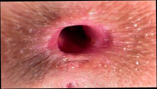 Video 1624022903: girl fart fetish, anal fart pussy, farting ass licking, fetish teen anally, fetish amateur teen, girl face fart, big ass farting, stepdaughter anal, old fart teen, blonde girl farting, extreme fetish anal, old farts young, fart fantasy, stepdaughter queen, farting close, girl steps, fucking