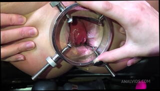 Video 1617205585: lesbian mistress, mistress anal fisting, teen lesbian fisting, lesbian women, slim lesbian, ass hole wrecked, ass bulge, belly ass