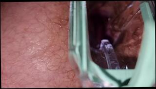 Video 1611828963: solo gay uncut, chubby gay solo, fetish gay solo, chubby bear solo, uncut solo male, amateur chubby ass, chubby amateur anal, speculum ass, gay male medical fetish, european male solo, white ass