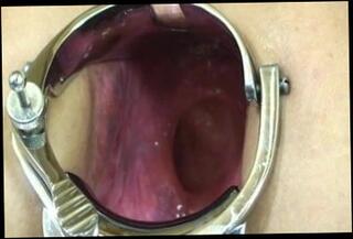 Video 65727401: wife anal gape, gaping anal toying, gaping anal sex, extreme anal gape, gaping ass, speculum extreme, brutal dildos, anal sex straight, ass stretched, huge toy, climax, fisting, orgasm