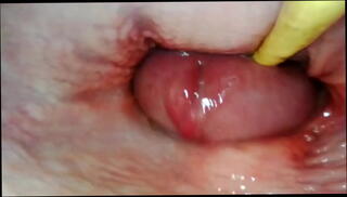Video 1653929155: cum farting anal gape, ass gaping anal creampie, creampie pussy squirt orgasm, gaping ass hole creampied, squirt orgasm huge creampie, gape creampie fuck, squirt hard fucking creampie, cumshots creampie squirting, booty fucked creampied, creampie sex squirting, big gapes farts, creampie multiple squirt, gaping ass fucked slut, anal gaping fuck whore, gaping asses wet pussies, sex perfect gaping asses, orgasm tight pussy creampie, ass big booty bubble, big titted booty ass, gaping ass hole destroyed, gaping pink ass hole, creampie huge cum load, creampie multiple cumshots passionate, anal gape queen, gaping mature pussy, wild creampie orgasm, sensual fuck creampie, romantic sex creampie, small pussy creampie, fast creampie, amazing pov, camera inside pussy