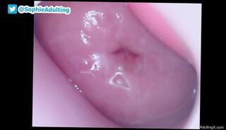 Video 1655518803: speculum pussy gape, closeup gaping pussy, closeup pov pussy, closeup pov masturbation, amateur closeup pov, closeup solo masturbation, fetish solo masturbation, pov solo female, masturbate wet pussy closeup, hardcore pussy gaping, gaping wet vagina, pink pussy closeup, pov deep pussy, shrink giantess pov, behind closeup, camera closeup, inside vagina, vagina play, webcam play