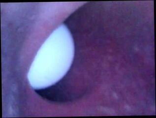 Video 279204701: anal balls toy, ass toying anal, ass sex toy, hardcore anal ass, anal sex straight, balls inside ass, ass balls deep, sex toy close, balls clean, camera inside ass