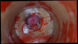 Video 1658639813: creampie pov compilation, amateur anal creampie compilation, dick pov creampie, creampie compilation part 1, multiple creampie compilation, creampie compilation big