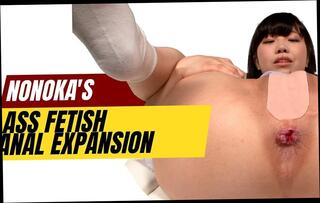 Video 1662705301: dildo anal fingering, dildo fingers ass, anal dildo fetish, expansion fetish, fingers big dildo, big dildo anal sex, anal dildo pleasure, anal dildo experience, anal dildo close, asian anal dildo, japanese anal dildo, anal dildo hd, straight dildo, dildo explores, secret dildo, intimate fingering