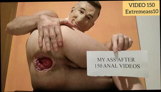 Video 1599483835: gaping fisting anal ass, anal fisting gaping extreme, gaping fisting anal holes, gay gaping ass hole, ass big anal gapes, gaping destroyed ass, huge gaping ass hole, gaping ruined, crazy gaping, very extreme gay ass