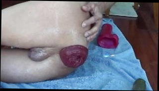 Video 1066425901: fisting gape prolapse, dildo fisting prolapse, anal gape prolapse, anal dildos gape huge, anal fisting dildo toy, dildo fisting sex toy, cock anal dildo toy, huge gay anal dildo, amateur anal gape, prolapsed cunt, beautiful prolapse