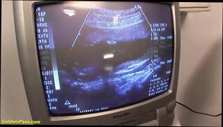 Video 1657389631: pregnant preggo, preggo fetish, pregnant doctor, pregnant redhead fucking, fetish rough fuck, doctor straight, extreme preggo, preggo belly, doctor medical, crazy doctor, fetish hd, fucking hungarian, clinic fuck