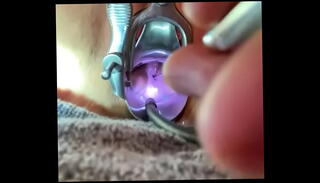 Video 1151870095: sadism masochism, fetish penetrating, pain fetish, insertion fetish, fetish sounding, medical fetish, gentle penetration