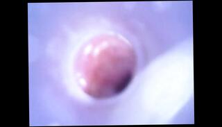 Video 1664668811: gay twink creampie, gay twink fetish, latino twink creampie, cock sounding urethral fetish, twink jerks cock, twink jerking big cock, twink jerking cumming, amateur twink jerking, twink handjob cumshot, twinks cum inside, twink cam, twink hd, dick inside, camera dick