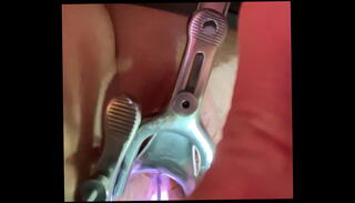 Video 1152626125: sadism masochism, pussy speculum, fetish penetrating, inserts speculum, medical speculum, fetish sounding, fetish shaved