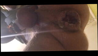 Video 1647226395: squirt anal plug, prolapse fisting ass, twink anal fisting, twink anal orgasm, sexy twink ass, gay twink fisting, hot anal plug, long twink cock, twink whore