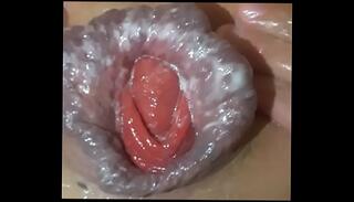 Video 822942415: prolapsed ass holes, pussy prolapse, prolapse gay, anal