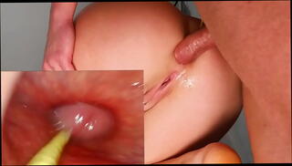 Video 1655786365: cum farting anal gape, ass gaping anal creampie, fucked creampied 3d sex, squirting orgasm creampie anal, creampie pussy squirt orgasm, gaping ass hole creampied, huge cumshot creampie 3d, squirt hard fucking creampie, booty fucked creampied, big gapes farts, creampie multiple squirt, anal gaping fuck whore, gaping ass fucked slut, anal creampie deep ass, sex perfect gaping asses, cum filled pussy creampie, gaping asses wet pussies, tight ass anal creampie, ass big booty bubble, tits big ass creampied, gaping ass hole destroyed, gaping pink ass hole, creampie multiple cumshots passionate, anal gape queen, creampie huge cum load, wild anal gaping, sensual fuck creampie, mature anal gape, romantic sex creampie, small pussy creampie, fast creampie, camera creampie, best anal