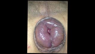 Video 724698503: solo pumped, anal pump toy, pumped ass fucked, gay ass solo, solo amateur toys, solo male ass, pump close