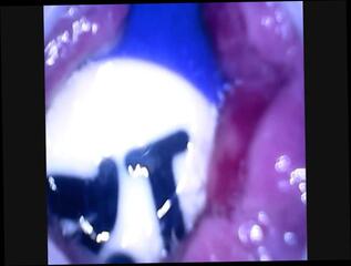 Video 319719601: anal balls toy, ass toying anal, ass sex toy, hardcore anal ass, anal sex straight, balls inside ass, ass balls deep, ass anal hd, pool balls, camera inside ass