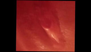 Video 1594299045: clit squirt, swollen clit