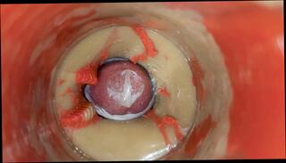 Video 1664900521: condom gay sex, condom toy, condom masturbation, amateur condom, condom close, male condom, toy gay man, gay sex hd, pussy filled