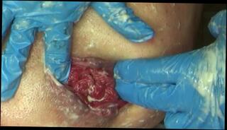 Video 858483803: gape prolapse, femdom squirt, femdom fetish, fisting squirting orgasms, squirt wife fisted, femdom anal fisting, squirting girl fisting, squirting amateur girl, anal fetish couple, extreme fisting squirt, femdom fist guy, femdom husband, prostate cumshot, femdom women, anal squirt hd, femdom handjob, men squirting