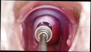 Video 40927535: speculum pussy gape, closeup gaping pussy, doctor gaping, femdom doctor, closeup pussy spreading, amateur pussy closeup, pussy speculum exam, blonde pussy gaping, doctors clinic, doctor hospital, vagina examination, babe examined, bizarre pussy, examination hot