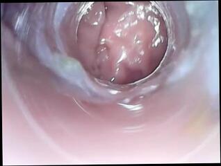 Video 1060174103: fetish anal toys, amateur anal fetish, hardcore fetish, fetish camera