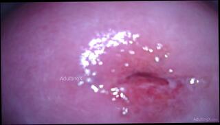 Video 1665332063: speculum pussy gape, closeup pov masturbation, closeup solo masturbation, amateur closeup pov, fetish solo masturbation, pov solo female, dirty talk solo masturbation, masturbate wet pussy closeup, hardcore pussy gaping, gaping wet vagina, dirty pov giantess, pink pussy closeup, solo masturbation deep, shrink giantess pov, camera closeup, behind closeup