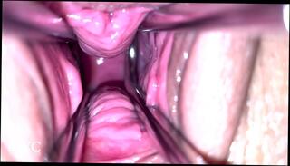 Video 1611775683: speculum pussy gape, hairy pussy fetish, cum gaping pussy, amateur fetish couple, hairy pussy orgasm, hairy pussy toyed, hairy pussy cumshot, pussy speculum exam, fetish handjob, gaping male, fetish female