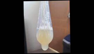 Video 1628967981: condom creampie, doctor creampied, condom gay porn, sperm condom, condom cumshot, creampie hd porn, couple creampie, filled condom, loaded condom, indian condom, sperm jizz