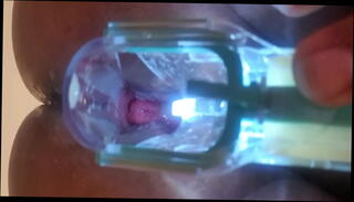 Video 1658075505: big booty massage, big booty pov, butt big ass booty, anal ass booty big, cock anal massage, cock massage masturbation, gay anal massage, massage big ass perfect, beauties big booty anal, anal speculum