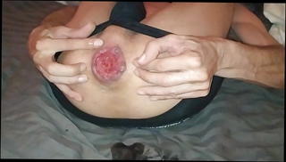 Video 1444257301: anal fisting prolapse, shemale prolapse, anal fisting hd, ass spread, open ass, ass hole