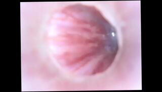 Video 1656165875: urethra, cam