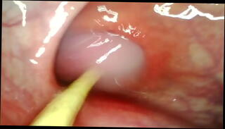 Video 1655786405: cum farting anal gape, ass gaping anal creampie, squirting orgasm creampie anal, fucked creampied 3d sex, creampie pussy squirt orgasm, gaping ass hole creampied, huge cumshot creampie 3d, squirt hard fucking creampie, booty fucked creampied, big gapes farts, creampie multiple squirt, gaping ass fucked slut, anal gaping fuck whore, cum filled pussy creampie, sex perfect gaping asses, gaping asses wet pussies, tight pussy gaping ass, ass big booty bubble, big titted booty ass, gaping ass hole destroyed, gaping pink ass hole, creampie multiple cumshots passionate, creampie huge cum load, anal gape queen, wild anal gaping, mature anal gape, sensual fuck creampie, romantic sex creampie, small tits big booty, anal pov, fast creampie, ass big cock cum, ass hole cumming inside, ass cum deep inside, ass pounded cum, camera inside ass