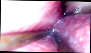 Video 1227842001: wide open, insertion gaping, gape play, gape hd, urethral straight, urethra insertion