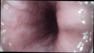 Video 1611677993: solo prostate, solo amateur trans, insertion solo, masterbation