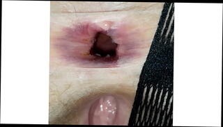 Video 1577555095: gaping farting ass hole, gape farting anal, gape pussy fart, gaping ass hole toyed, gaping ass masturbating, gaping butt toyed, gaping vagina, anal vaginal masturbation