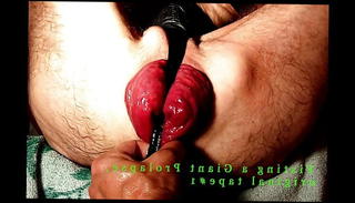 Video 1568922951: interracial bareback anal, interracial gay bareback, asian interracial bareback, anal fisting prolapse, giant prolapse, french bareback