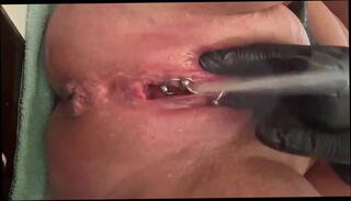 Video 1600357705: milf pissing pee, milf fingering squirting, solo fingering squirt, milf fingers ass pussy, solo fingering pussy masturbating, gaping ass hole fingered, solo ass hole worship, pissing peeing girls, amateur milf pee, squirting big ass milf, homemade milf squirt, squirter fingering, european milf fingers, milf masturbating pierced pussy, lovers ass fingers pussy, pussy fingering clit, juicy gaping ass, pussy pee close, gaping white ass, pretty pussy squirt, girl fingering bathroom, fingering small pussy, latex pussy, strong pee, latex hand, very pussy