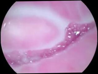 Video 1624125293: amateur orgasm solo, vagina solo, solo female orgasm, camera solo, camera inside vagina, pussy
