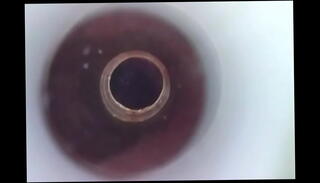 Video 1520839255: camera closeup, insertion closeup, urethra