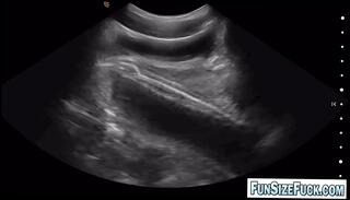 Video 1663296505: alex gonz, doctor barebacks twink, gay bareback twink boy, bareback twink sucking cock, twink bareback gay porn, bareback twink gay sex, bareback gay hardcore twink, big dick twinks bareback, barebacks young twink gay, twink bareback anal, twinks blowjob bareback, twink teen bareback, monster cock bareback gay, twink ass dick, twink ass destroyed, twink huge dick, twink sucks old, doctors clinic