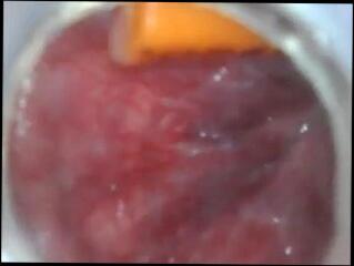 Video 269815501: condom ass, inserts condom, inside condom, gay anal sex toy, gay deep anal sex