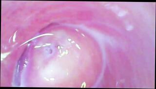 Video 1624125373: amateur orgasm solo, vagina solo, solo female orgasm, camera solo, camera inside vagina