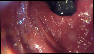 Video 1612319113: twinks tiny ass, tiny gay twink, twink anal gaping, pov anal gape, pov amateur twink, solo anal gaping, fetish twinks anal, twink gaping hole, vore pov, solo male pov, gaping ass hole toyed, giant vore, fucking
