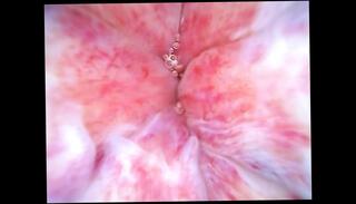 Video 1656133671: ass hole anal masturbation, ass toying anal, gay ass anal, ass loves anal, anal toy close, ass hole hd