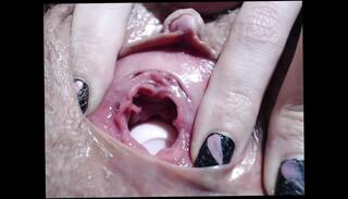 Video 1656008671: gaping fetish, cum gaping pussy, fetish pussy play, pussy gape close, balls fetish, fetish vagina, big gaping pussy, gaping snatch, gaping twat, big clit fetish, gaping cunt, straight gape, fetish awesome, muscle fetish, high fetish, gape hd, balls inside pussy, cum inside wet pussy, perfect pussy cum, pussy multiple times, english cum