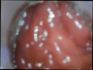 Video 269817001: bdsm anal fisting, bdsm sex anal, anal toys bdsm, bdsm anal play, bdsm ass, straight bdsm, medical bdsm, anal toy inside